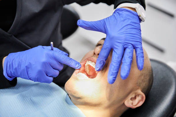 Best Emergency Root Canal Treatment in St Paul, MN